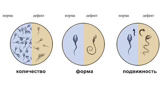 Сдать анализ спермограммы в клинике.